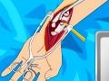 Jwèt Arm surgery 2