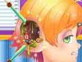 Jwèt Funny Ear Surgery
