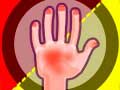 Jwèt Hands Attack