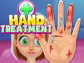 Jwèt Hand Treatment