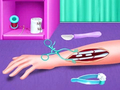 Jwèt Fracture Emergency Surgery
