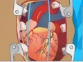 Jwèt Heart Surgery