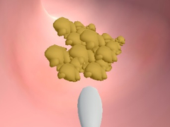 Jwèt Earwax Clinic